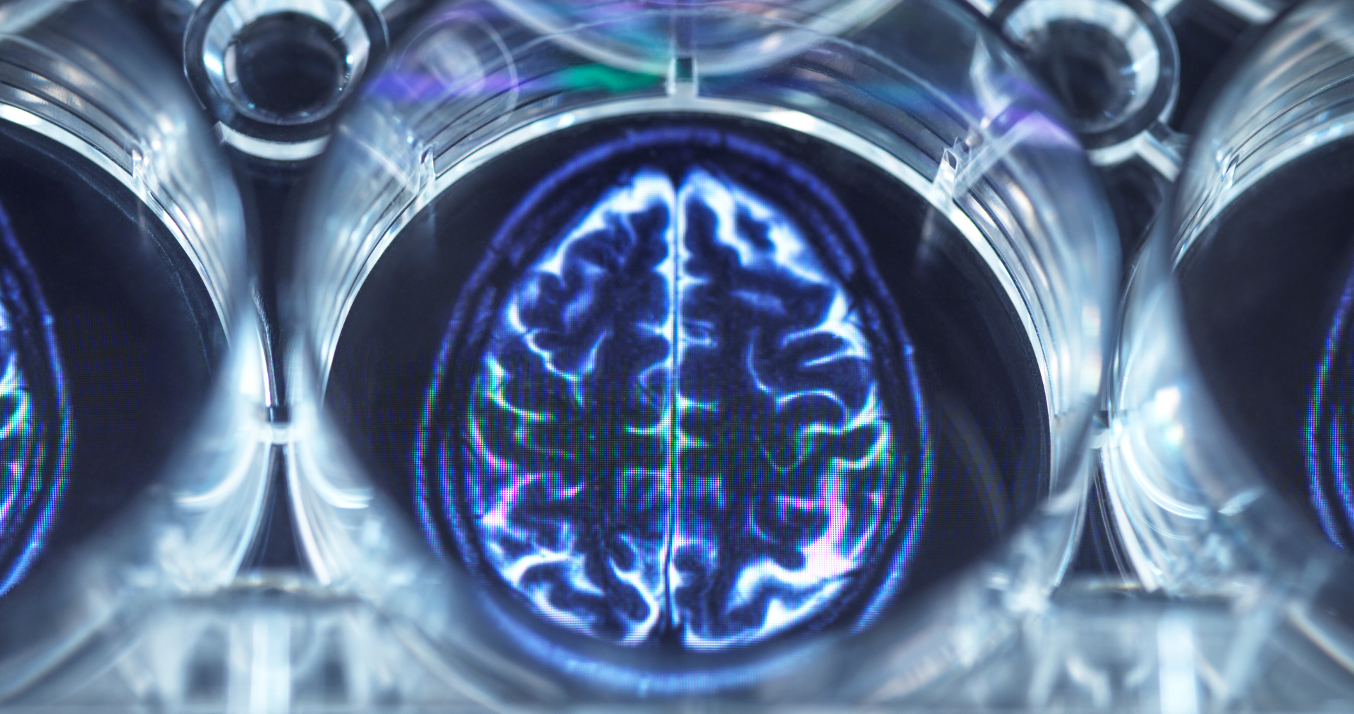 ESS60 and Neuroprotection: Shielding Your Brain from Oxidative Stress