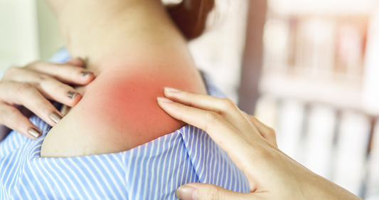 ESS60 Reducing Inflammation for Mobility