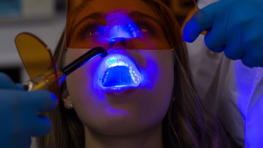 What Does Blue Light Therapy Do for Teeth?