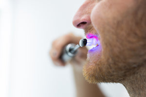 Light Therapy Toothbrush